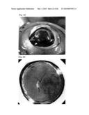 INJECTOR FOR EYE diagram and image