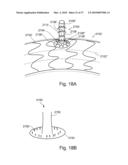 BRANCH STENT GRAFT FOR AORTIC ANEURYSM REPAIR diagram and image