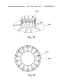 BRANCH STENT GRAFT FOR AORTIC ANEURYSM REPAIR diagram and image