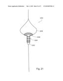 BRANCH STENT GRAFT FOR AORTIC ANEURYSM REPAIR diagram and image