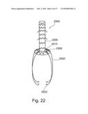 BRANCH STENT GRAFT FOR AORTIC ANEURYSM REPAIR diagram and image