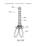 BRANCH STENT GRAFT FOR AORTIC ANEURYSM REPAIR diagram and image