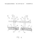 STAPLING DEVICE FOR CLOSING PERFORATIONS diagram and image