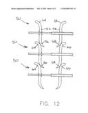 STAPLING DEVICE FOR CLOSING PERFORATIONS diagram and image