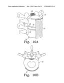 PEEK Spinal Mesh and PEEK Spinal Mesh Applicator diagram and image