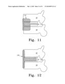 PEEK Spinal Mesh and PEEK Spinal Mesh Applicator diagram and image