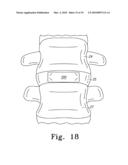 PEEK Spinal Mesh and PEEK Spinal Mesh Applicator diagram and image