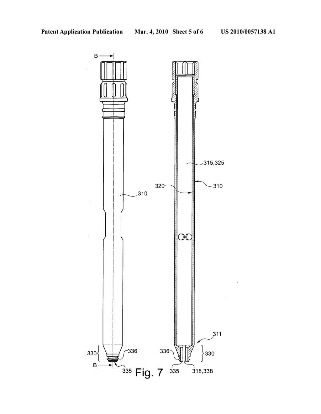 Locking screw with synchronized thread - diagram, schematic, and image 06