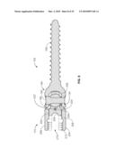 BONE ANCHOR FOR RECEIVING A ROD FOR STABILIZATION AND MOTION PRESERVATION SPINAL IMPLANTATION SYSTEM AND METHOD diagram and image