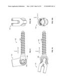 BONE ANCHOR FOR RECEIVING A ROD FOR STABILIZATION AND MOTION PRESERVATION SPINAL IMPLANTATION SYSTEM AND METHOD diagram and image