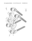 BONE ANCHOR FOR RECEIVING A ROD FOR STABILIZATION AND MOTION PRESERVATION SPINAL IMPLANTATION SYSTEM AND METHOD diagram and image