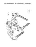 BONE ANCHOR FOR RECEIVING A ROD FOR STABILIZATION AND MOTION PRESERVATION SPINAL IMPLANTATION SYSTEM AND METHOD diagram and image