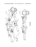 BONE ANCHOR FOR RECEIVING A ROD FOR STABILIZATION AND MOTION PRESERVATION SPINAL IMPLANTATION SYSTEM AND METHOD diagram and image