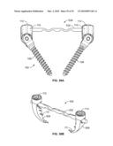 BONE ANCHOR FOR RECEIVING A ROD FOR STABILIZATION AND MOTION PRESERVATION SPINAL IMPLANTATION SYSTEM AND METHOD diagram and image