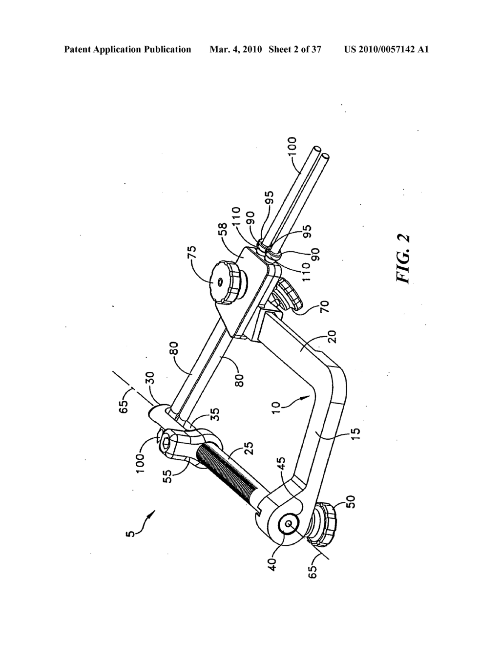 METHOD AND APPARATUS FOR FIXING A GRAFT IN A BONE TUNNEL - diagram, schematic, and image 03