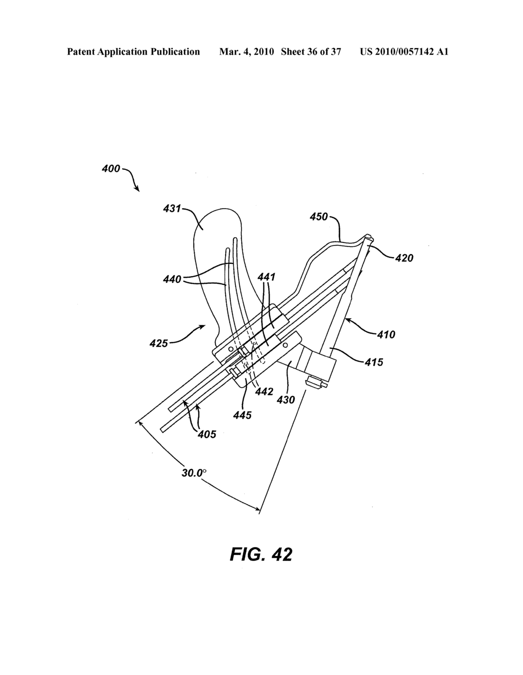 METHOD AND APPARATUS FOR FIXING A GRAFT IN A BONE TUNNEL - diagram, schematic, and image 37