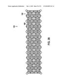 INTERIOR AND EXTERIOR SUPPORT SYSTEM FOR INTERVERTEBRAL DISC REPAIR diagram and image