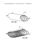 INTERIOR AND EXTERIOR SUPPORT SYSTEM FOR INTERVERTEBRAL DISC REPAIR diagram and image