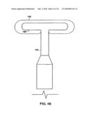 INTERIOR AND EXTERIOR SUPPORT SYSTEM FOR INTERVERTEBRAL DISC REPAIR diagram and image