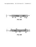 INTERIOR AND EXTERIOR SUPPORT SYSTEM FOR INTERVERTEBRAL DISC REPAIR diagram and image