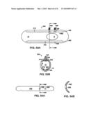 INTERIOR AND EXTERIOR SUPPORT SYSTEM FOR INTERVERTEBRAL DISC REPAIR diagram and image