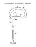 INTERIOR AND EXTERIOR SUPPORT SYSTEM FOR INTERVERTEBRAL DISC REPAIR diagram and image