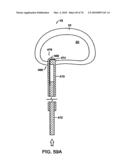 INTERIOR AND EXTERIOR SUPPORT SYSTEM FOR INTERVERTEBRAL DISC REPAIR diagram and image