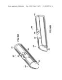 INTERIOR AND EXTERIOR SUPPORT SYSTEM FOR INTERVERTEBRAL DISC REPAIR diagram and image