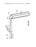 INTERIOR AND EXTERIOR SUPPORT SYSTEM FOR INTERVERTEBRAL DISC REPAIR diagram and image