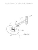 INTERIOR AND EXTERIOR SUPPORT SYSTEM FOR INTERVERTEBRAL DISC REPAIR diagram and image