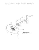 INTERIOR AND EXTERIOR SUPPORT SYSTEM FOR INTERVERTEBRAL DISC REPAIR diagram and image