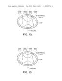 MULTIPLE TUNABLE CENTRAL CATHODES ON A PADDLE FOR INCREASED MEDIAL-LATERAL AND ROSTRAL-CAUDAL FLEXIBILITY VIA CURRENT STEERING diagram and image