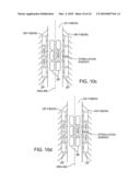 MULTIPLE TUNABLE CENTRAL CATHODES ON A PADDLE FOR INCREASED MEDIAL-LATERAL AND ROSTRAL-CAUDAL FLEXIBILITY VIA CURRENT STEERING diagram and image