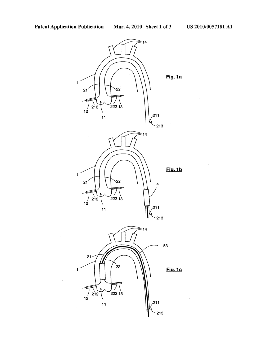 BLOOD VESSEL PROSTHESIS AND DELIVERY APPARATUS - diagram, schematic, and image 02