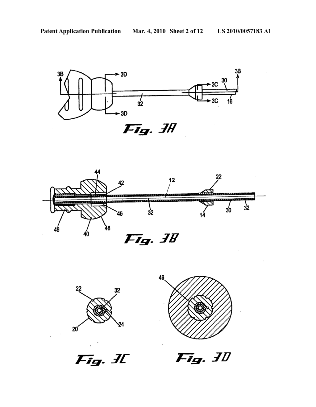 MEDICAL APPLIANCE OPTICAL DELIVERY AND DEPLOYMENT APPARATUS AND METHOD - diagram, schematic, and image 03