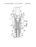 Sliding Split-Sleeve Implant Compressor diagram and image