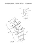 Joint Prosthesis having Infinitely Adjustable Head diagram and image