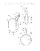 ARTHROPLASTIC IMPLANT WITH ANCHOR PEG FOR BASILAR JOINT AND RELATED METHODS diagram and image