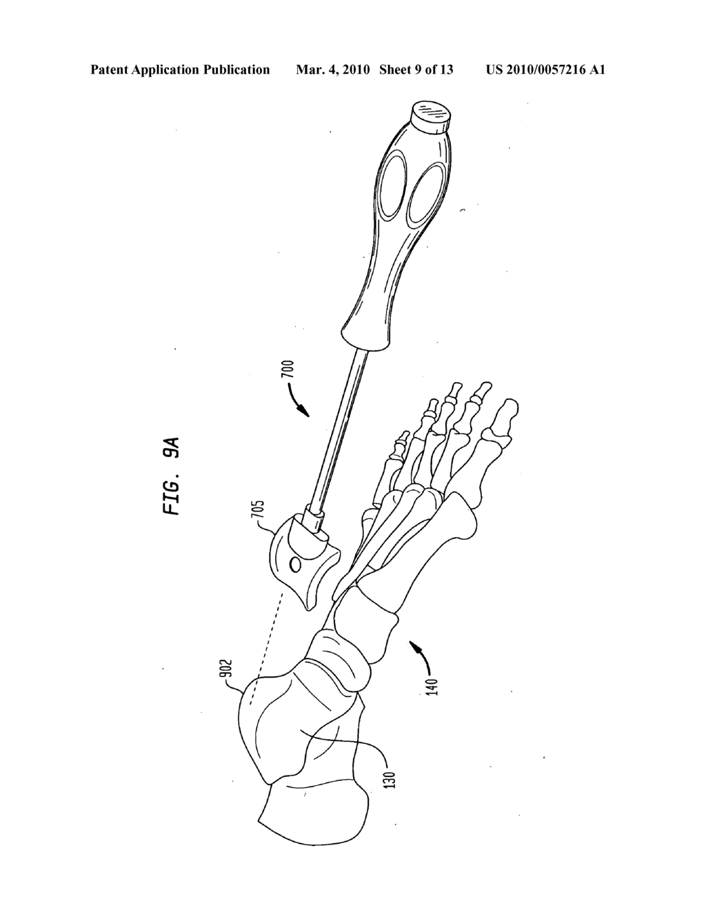 System and method for joint resurfacing with dynamic fixation - diagram, schematic, and image 10