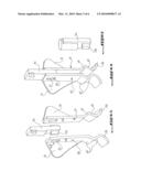 ANCHOR FOR HANDLING BUILDING ELEMENTS, IN PARTICULAR A CONCRETE PANEL diagram and image