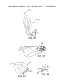 LARYNGEAL MASK AIRWAY DEVICE AND METHOD OF MANUFACTURE diagram and image