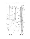 RETRACTABLE SHADE WITH COLLAPSIBLE VANES diagram and image