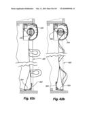 RETRACTABLE SHADE WITH COLLAPSIBLE VANES diagram and image