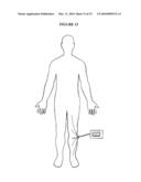 ELECTRODE SYSTEM AND LEAD ASSEMBLY FOR PHYSIOLOGICAL MONITORING diagram and image