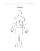 ELECTRODE SYSTEM AND LEAD ASSEMBLY FOR PHYSIOLOGICAL MONITORING diagram and image