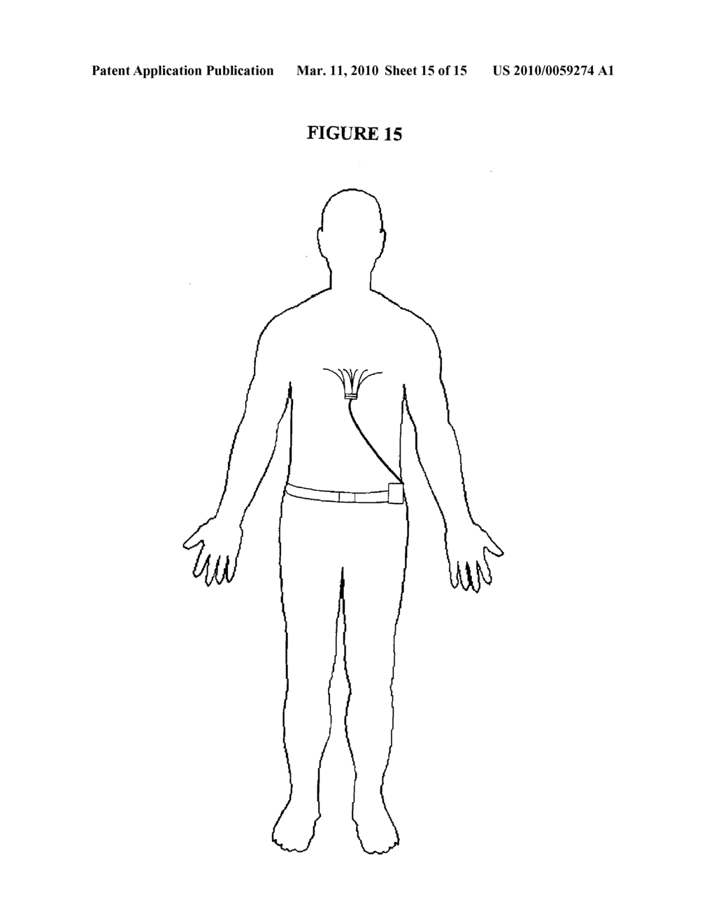 ELECTRODE SYSTEM AND LEAD ASSEMBLY FOR PHYSIOLOGICAL MONITORING - diagram, schematic, and image 16