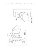 ANTI-SHOCK DEVICE diagram and image