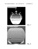 COMPUTER TOMOGRAPHY (CT) C-ARM SYSTEM AND METHOD FOR EXAMINATION OF AN OBJECT diagram and image