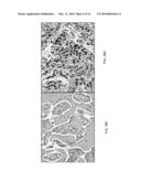 METHODS OF CHROMOGEN SEPARATION-BASED IMAGE ANALYSIS diagram and image