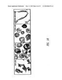 TRANSCOBALAMIN RECEPTOR POLYPEPTIDES, NUCLEIC ACIDS, AND MODULATORS THEREOF, AND RELATED METHODS OF USE IN MODULATING CELL GROWTH AND TREATING CANCER AND COBALAMIN DEFICIENCY diagram and image